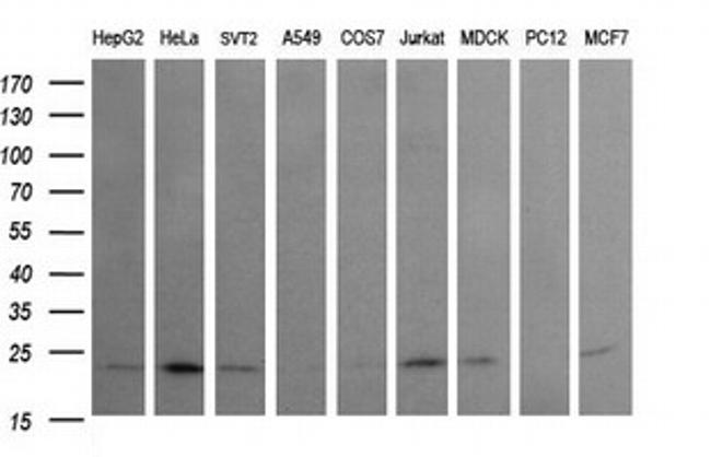 RAB24 Antibody in Western Blot (WB)