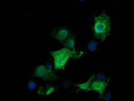 RAB30 Antibody in Immunocytochemistry (ICC/IF)