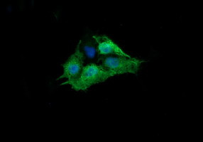 RAB30 Antibody in Immunocytochemistry (ICC/IF)