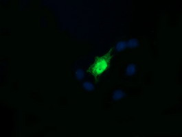 RAB30 Antibody in Immunocytochemistry (ICC/IF)