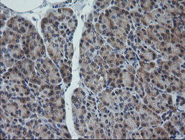 RAB30 Antibody in Immunohistochemistry (Paraffin) (IHC (P))