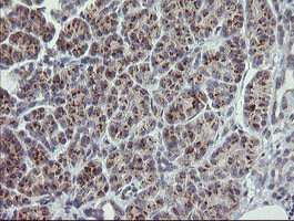 RAB30 Antibody in Immunohistochemistry (Paraffin) (IHC (P))