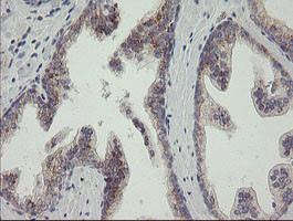 RAB30 Antibody in Immunohistochemistry (Paraffin) (IHC (P))