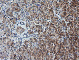 RAB30 Antibody in Immunohistochemistry (Paraffin) (IHC (P))