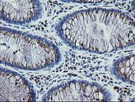 RAB30 Antibody in Immunohistochemistry (Paraffin) (IHC (P))