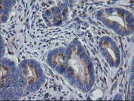 RAB30 Antibody in Immunohistochemistry (Paraffin) (IHC (P))