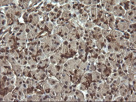 RAB30 Antibody in Immunohistochemistry (Paraffin) (IHC (P))