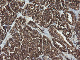 RAB30 Antibody in Immunohistochemistry (Paraffin) (IHC (P))