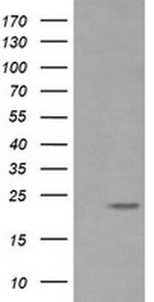 RAB30 Antibody in Western Blot (WB)