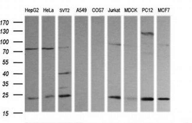 RAB30 Antibody in Western Blot (WB)