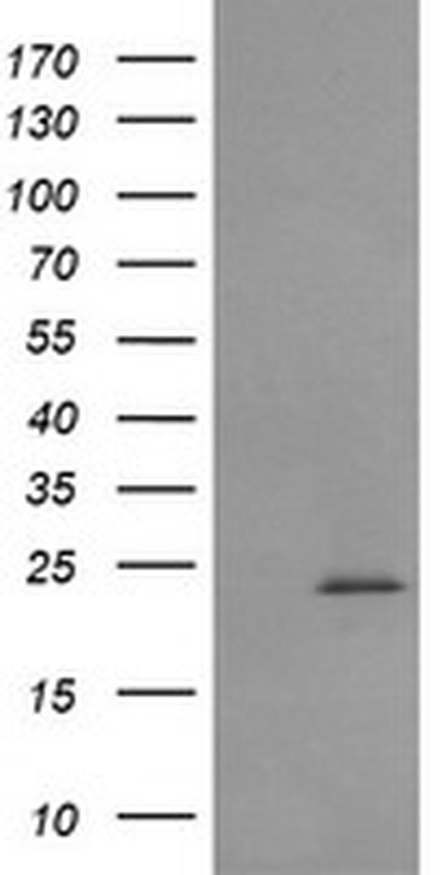 RAB30 Antibody in Western Blot (WB)