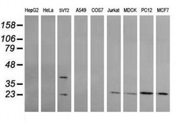 RAB30 Antibody in Western Blot (WB)