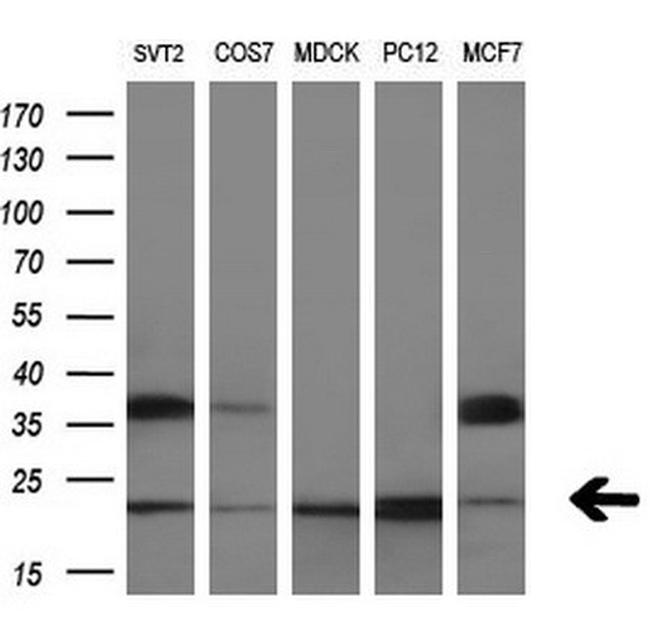 RAB30 Antibody in Western Blot (WB)