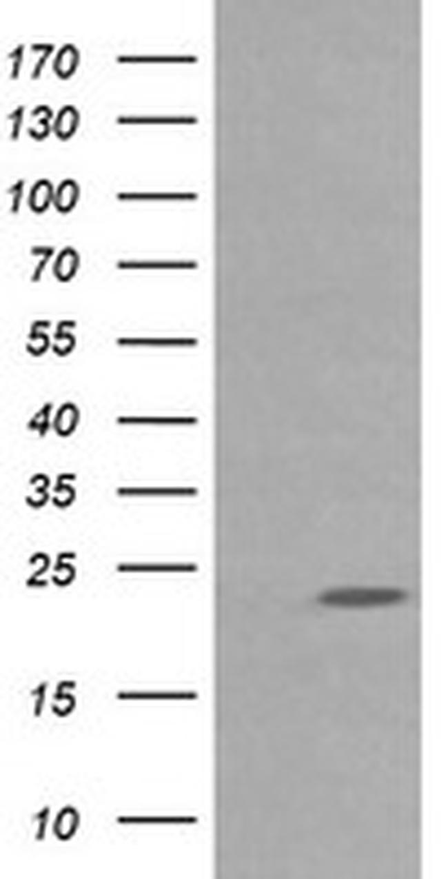 RAB30 Antibody in Western Blot (WB)