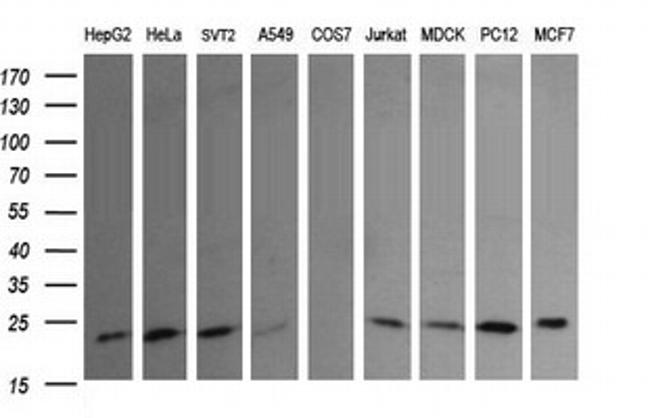 RAB30 Antibody in Western Blot (WB)