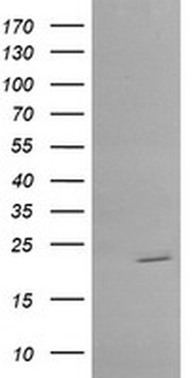 RAB30 Antibody in Western Blot (WB)