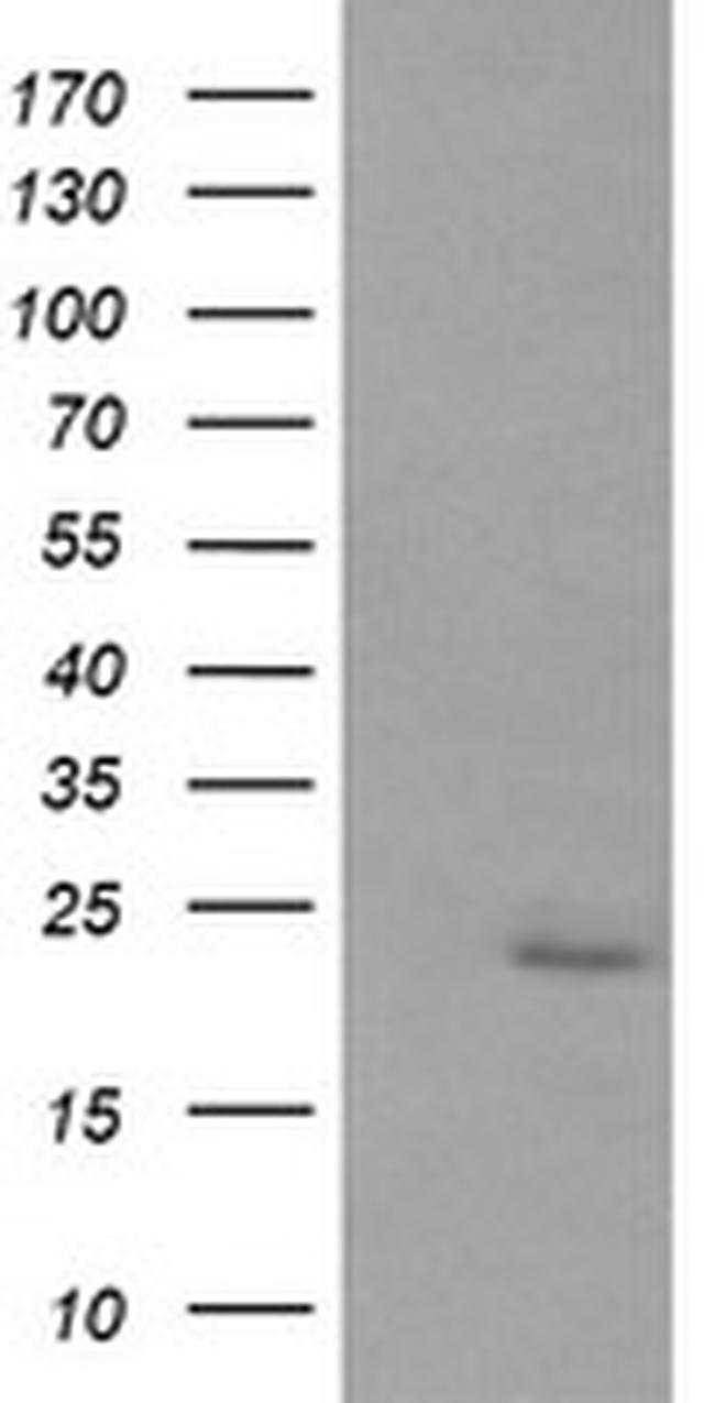 RAB30 Antibody in Western Blot (WB)