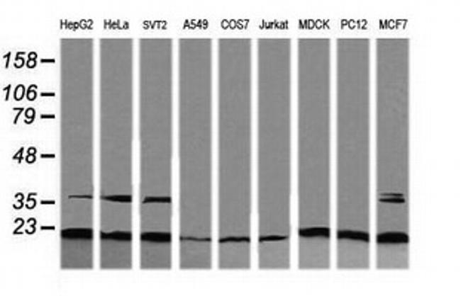 RAB30 Antibody in Western Blot (WB)