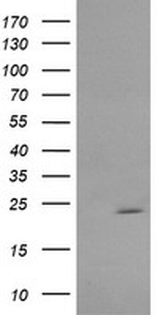 RAB30 Antibody in Western Blot (WB)