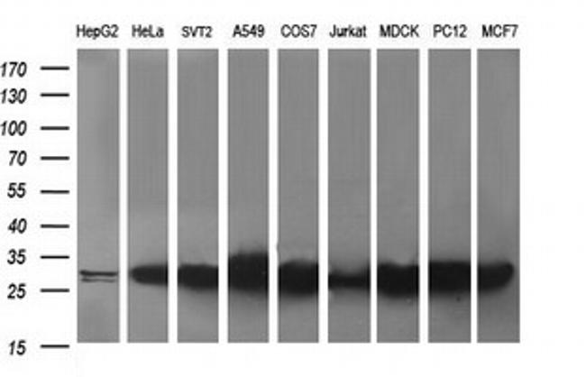 RAB30 Antibody in Western Blot (WB)