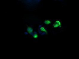 RAB37 Antibody in Immunocytochemistry (ICC/IF)