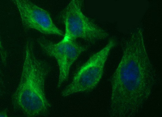 RAB37 Antibody in Immunocytochemistry (ICC/IF)