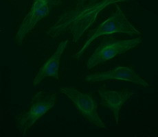 RAB37 Antibody in Immunocytochemistry (ICC/IF)