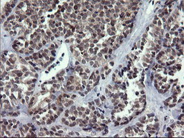 RAB37 Antibody in Immunohistochemistry (Paraffin) (IHC (P))