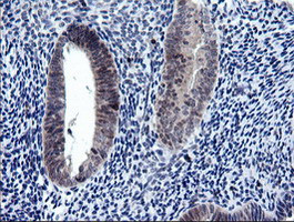 RAB37 Antibody in Immunohistochemistry (Paraffin) (IHC (P))