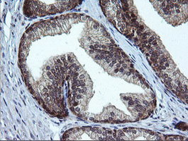 RAB37 Antibody in Immunohistochemistry (Paraffin) (IHC (P))