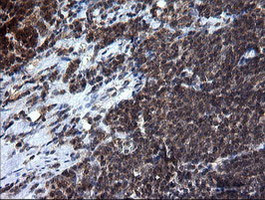 RAB37 Antibody in Immunohistochemistry (Paraffin) (IHC (P))