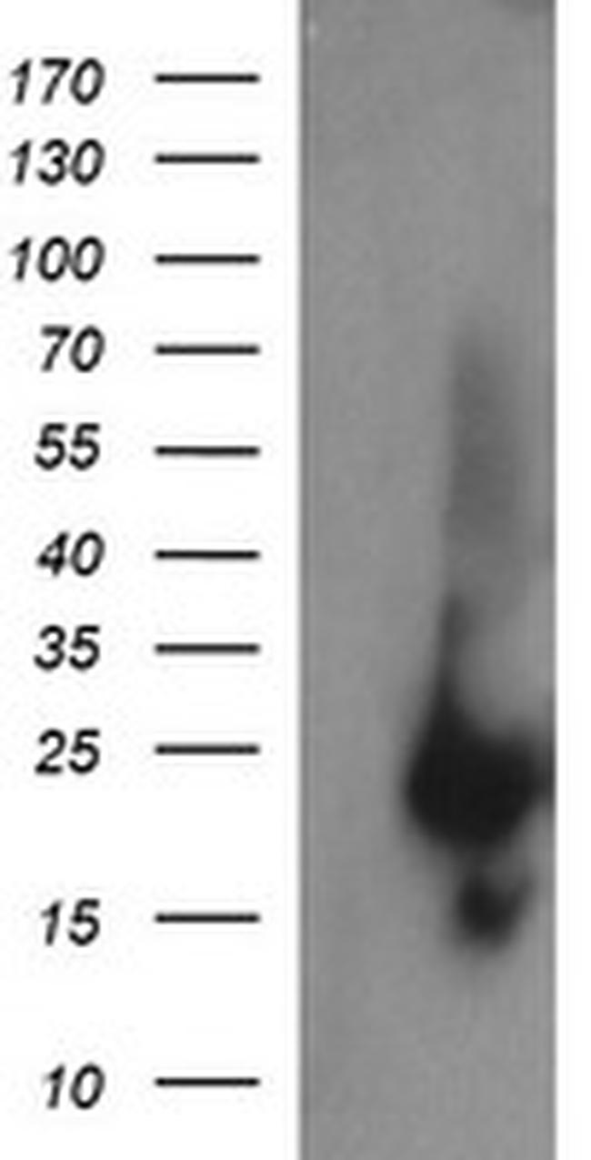 RAB37 Antibody in Western Blot (WB)