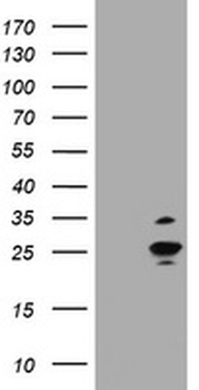 RAB37 Antibody in Western Blot (WB)