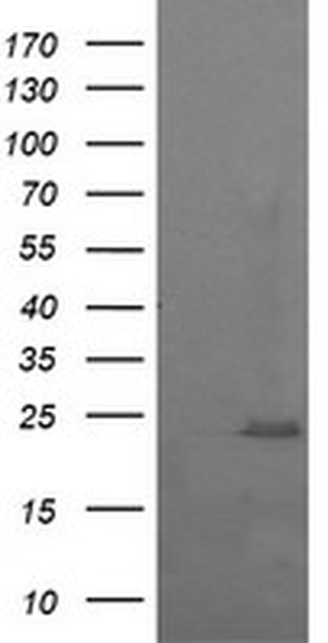 RAB37 Antibody in Western Blot (WB)