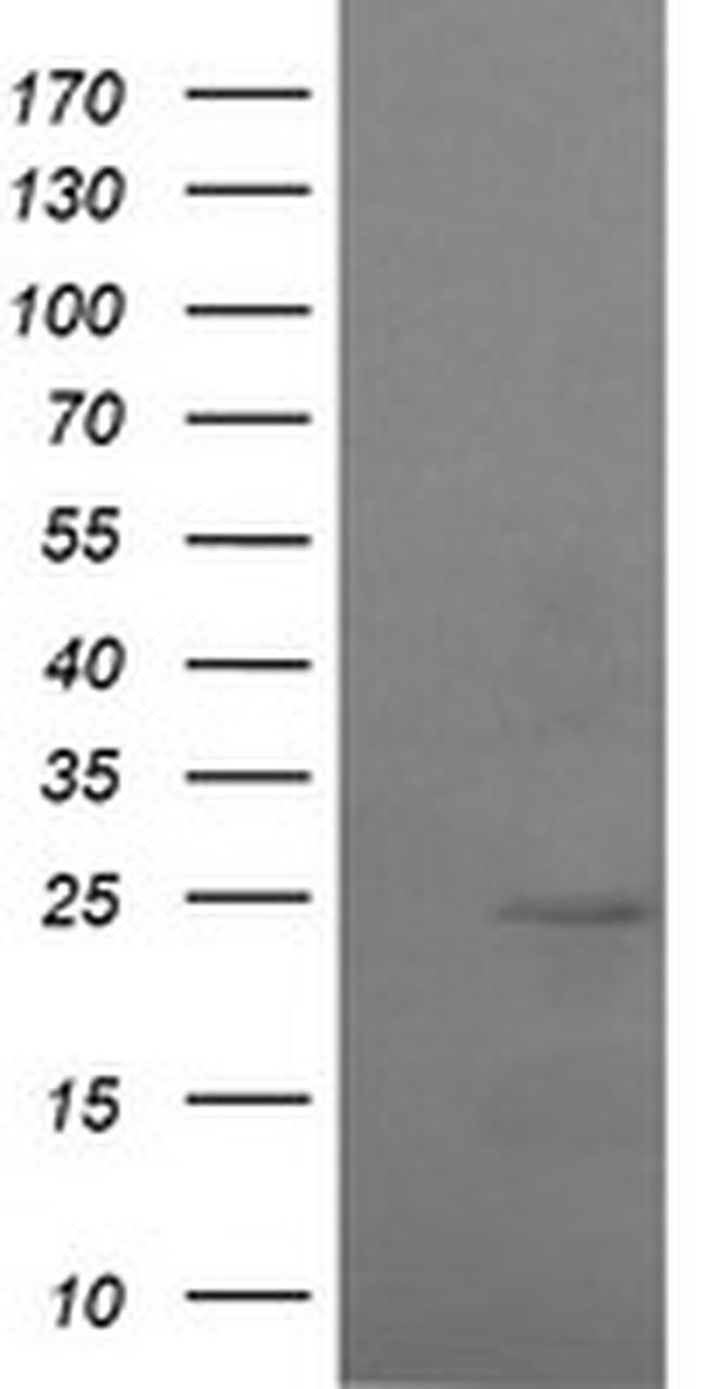 RAB37 Antibody in Western Blot (WB)