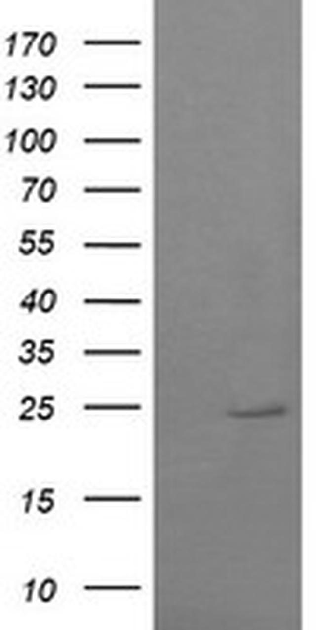 RAB37 Antibody in Western Blot (WB)