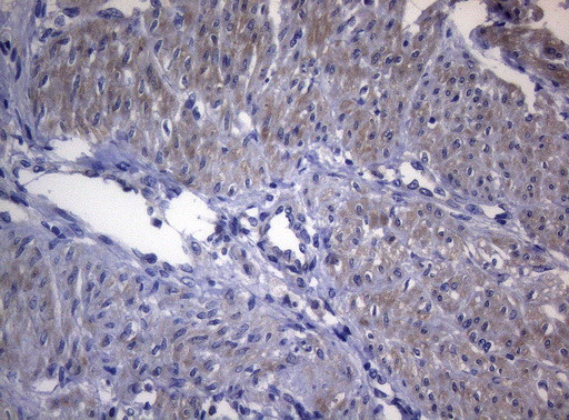 RAB3A Antibody in Immunohistochemistry (Paraffin) (IHC (P))