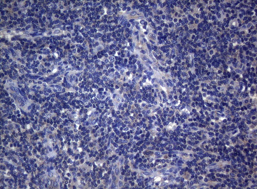 RAB3A Antibody in Immunohistochemistry (Paraffin) (IHC (P))