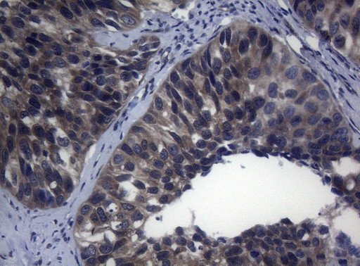 RAB3A Antibody in Immunohistochemistry (Paraffin) (IHC (P))