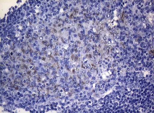 RAB3A Antibody in Immunohistochemistry (Paraffin) (IHC (P))