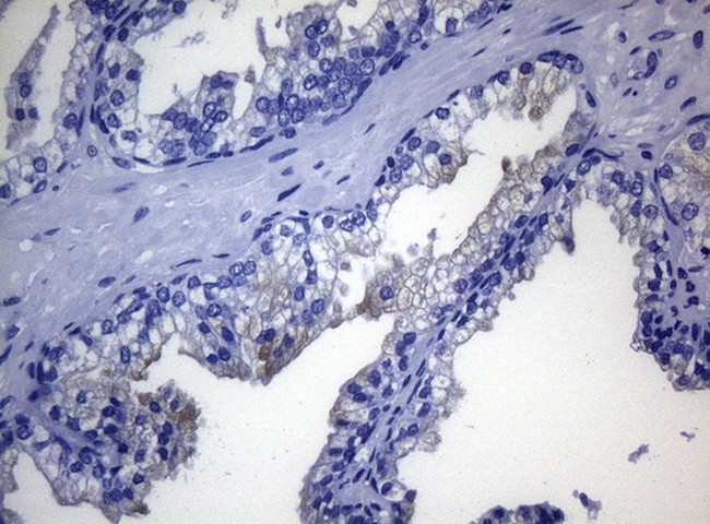 RAB3A Antibody in Immunohistochemistry (Paraffin) (IHC (P))