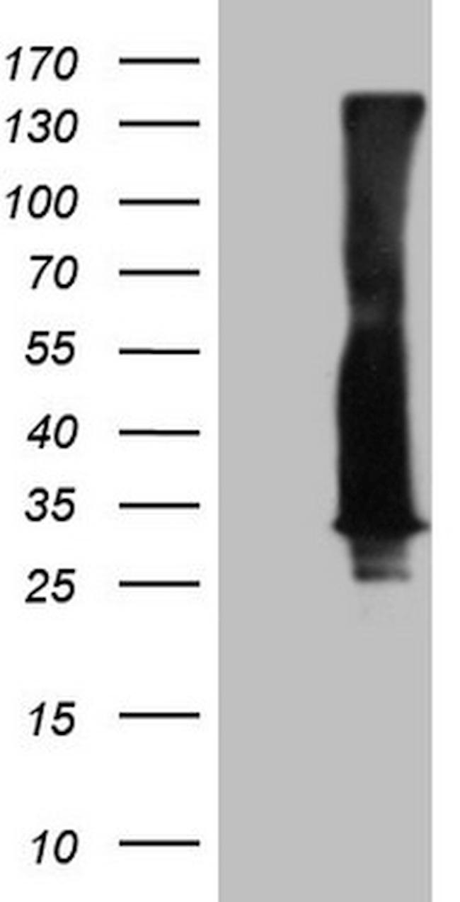 RAB3A Antibody in Western Blot (WB)