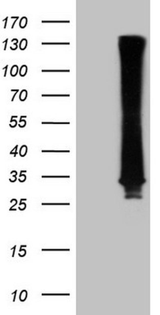 RAB3A Antibody in Western Blot (WB)