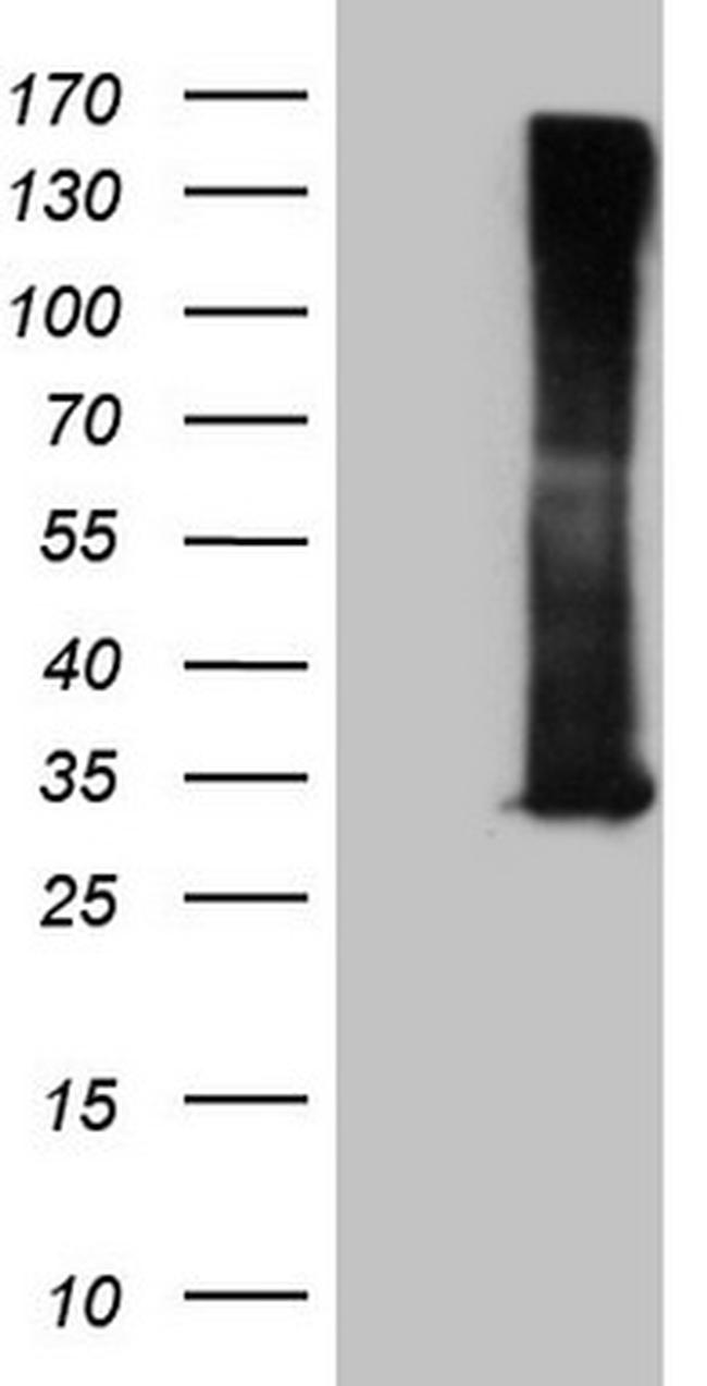 RAB3A Antibody in Western Blot (WB)