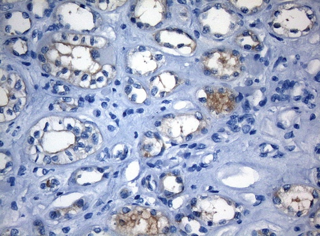 RAB3IP Antibody in Immunohistochemistry (Paraffin) (IHC (P))