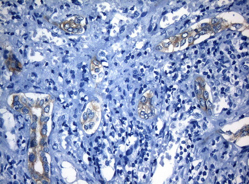 RAB3IP Antibody in Immunohistochemistry (Paraffin) (IHC (P))