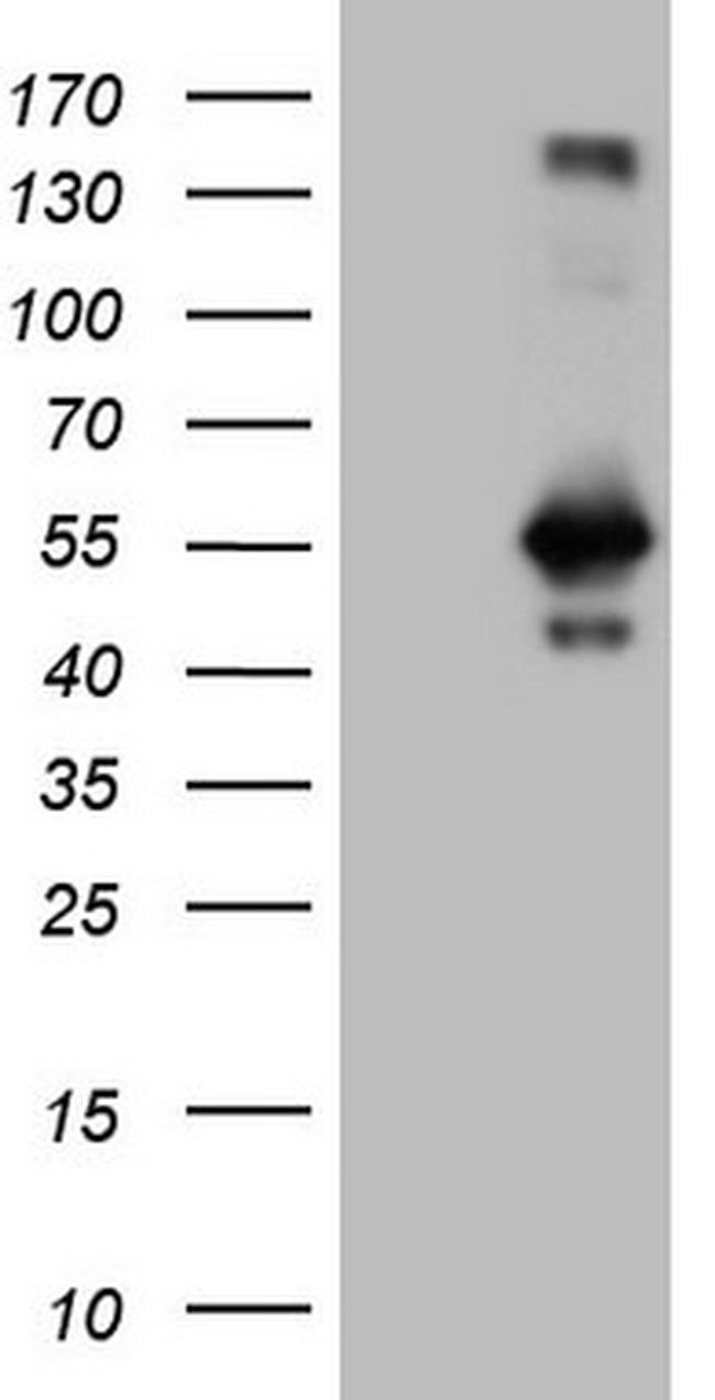 RAB3IP Antibody in Western Blot (WB)