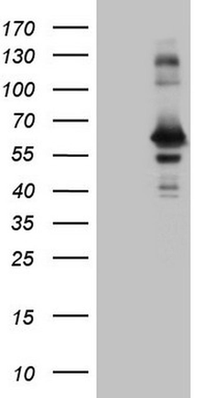 RAB3IP Antibody in Western Blot (WB)