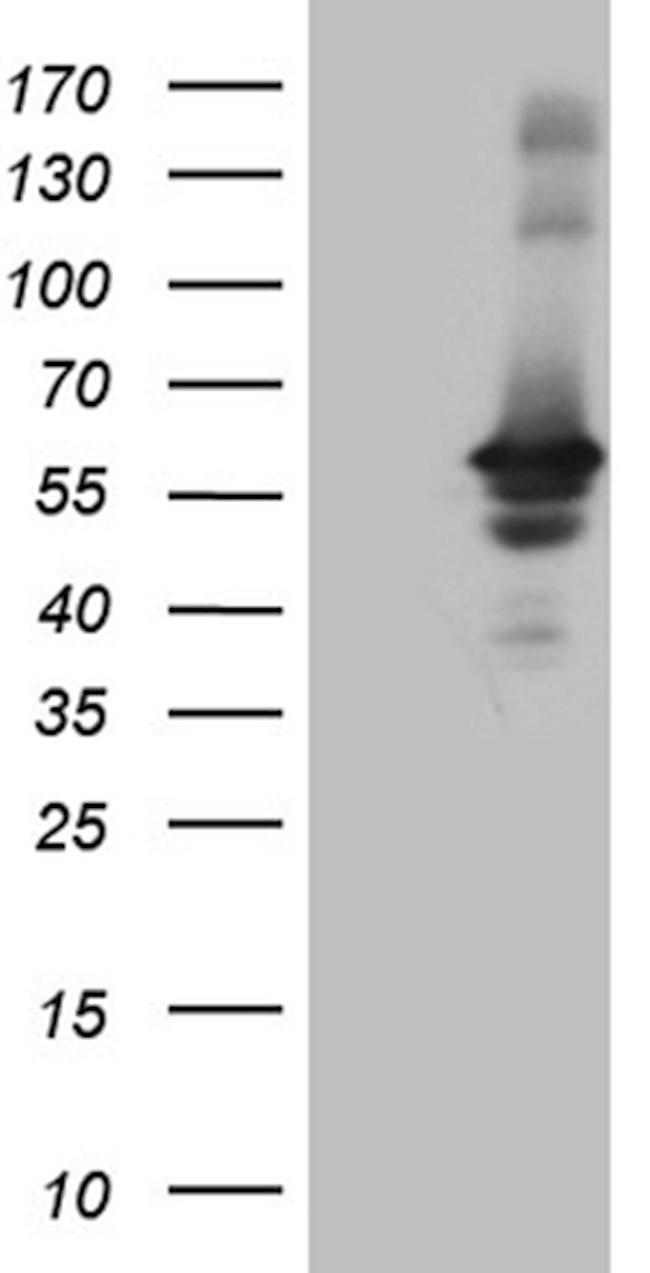 RAB3IP Antibody in Western Blot (WB)