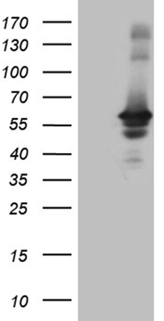 RAB3IP Antibody in Western Blot (WB)